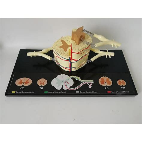 Modelo Anatómico Del Nervio De La Médula Espinal 5 Veces La Raíz