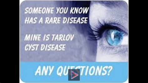 Tarlov Cyst Disease Much More Than An Incidental Finding Ajnr Youtube