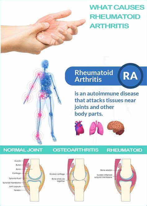 Autoimmune arthritis 