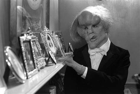 The Elephant Man 1980 Review