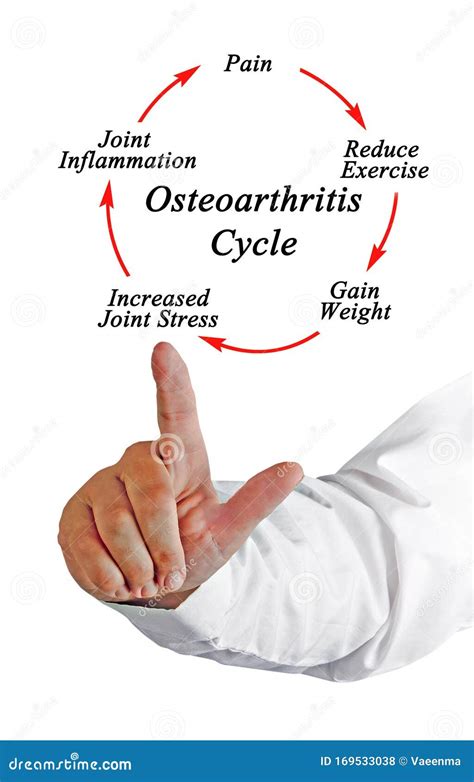 Components Of Osteoarthritis Cycle Coloso