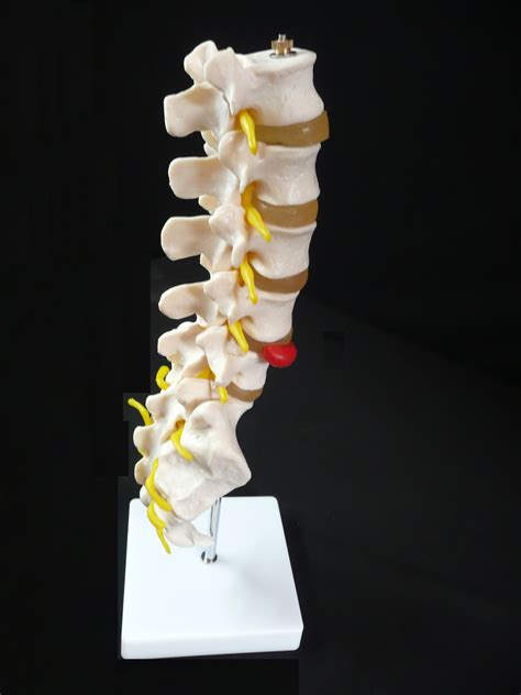 Lumbar Vertebrae Model Anatomical Spine Lumbar Disc Herniation Anatomy