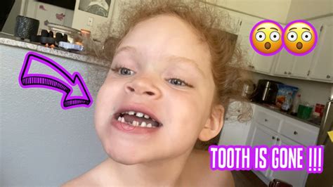 SHE LOST HER TOOTH YouTube