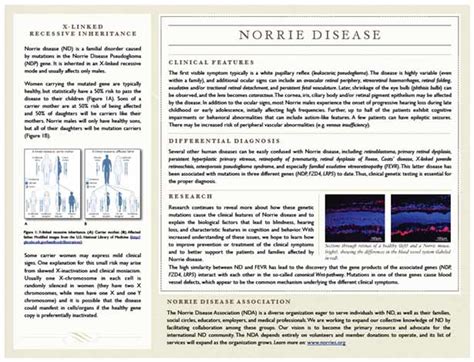 In addition to the congenital ocular symptoms. UZH - Institut für Medizinische Molekulargenetik - Norrie ...