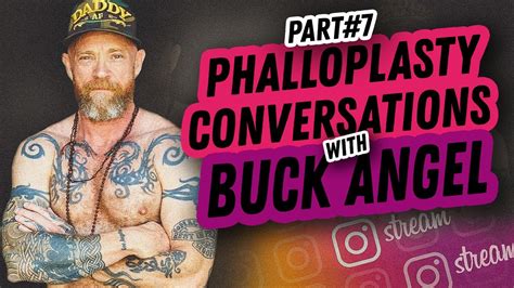 Sensation Phalloplasty Vs Metoidioplasty Phalloplasty Conversations With Buck Angel Part 7