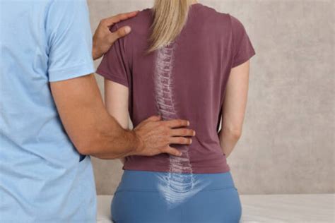 Chiropractic For Scoliosis Chiro Hours