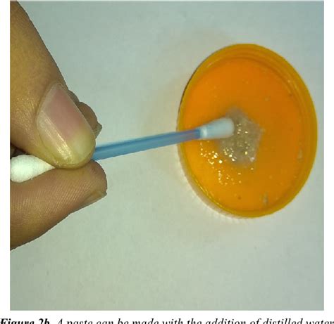 Figure 2 From Pre Activated Silver Nitrate For Umbilical Granuloma