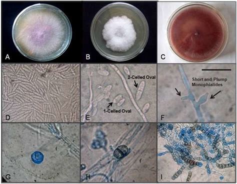 Fusarium Oxysporum A C Colony Morphology On Potato Dextrose Agar