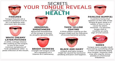 This Is What Your Tongue Has To Say About Your Health Health And Safety