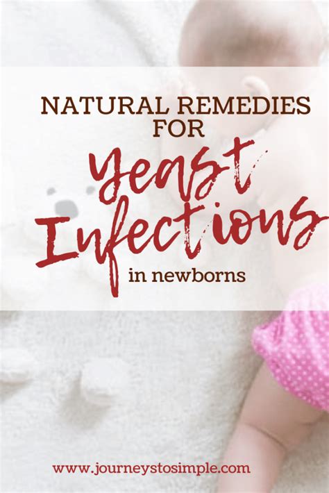 Home Remedies To Treat Yeast Infections In Your Baby Yeast Infection