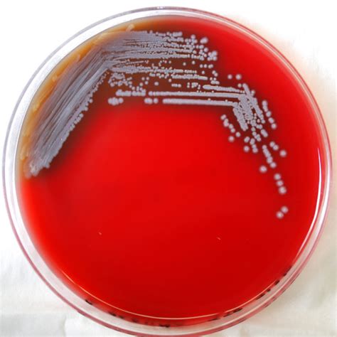 Melioidosis, also known as whitmore disease, is an infectious disease caused by the bacterium burkholderia pseudomallei. Melioidosis may be present in nearly half the world's ...