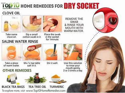 Socket Dry Remedies Tooth Pain Extraction Wisdom