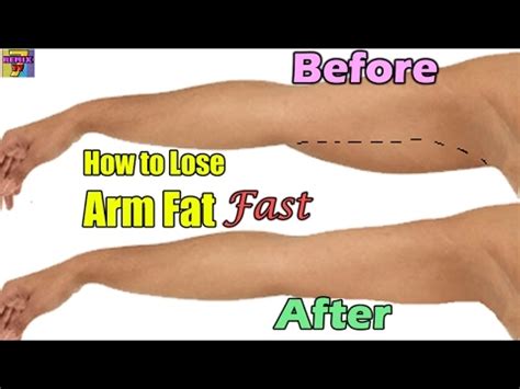 Dec 27, 2019 · not only does using a rowing machine get your heart rate way up, which helps you blast calories and burn fat, but it also works muscles in your legs, core, arms, shoulders, and back, says penfold. How to Lose Arm Fat Fast | Home Exercise Arm Fat Lose - 2017 NEW - YouTube