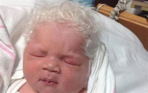 White Haired Baby Bence Goes Viral On Reddit