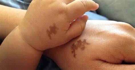 The Shape Of Your Birthmark Could Reveal A Hidden Message About Your Past