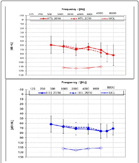 Average Hearing Loss And Standard Deviation Of Participants Measured