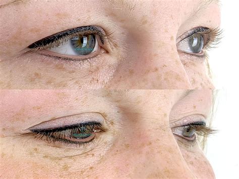 Permanent Eyeliner Atlanta Anna Burns Permanent Cosmetics