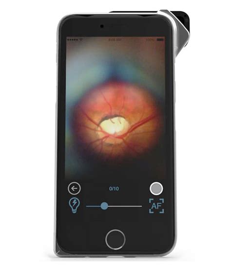 App Enabled Portable Fundus Camera For Smartphones D Eye Eye App