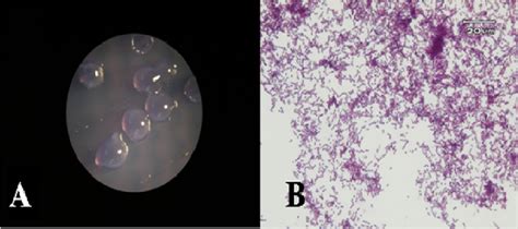 A Isolated Oral Streptococcus From Dental Plaque In Mitis Salivarius