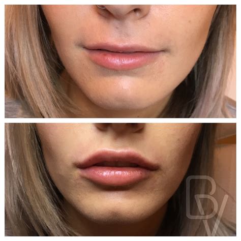 Before and After Photos of Bella Visage Clients - Lakeland