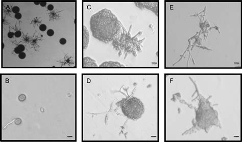 Figure From The Production Of Monokaryotic Hyphae By Cryptococcus Neoformans Can Be Induced By