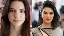 Fotografías que muestran el antes y el después de las Kardashian