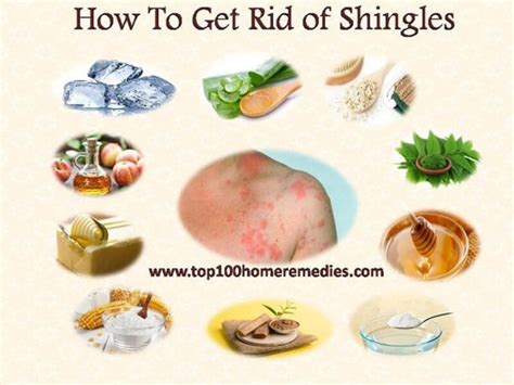 How To Use Apple Cider Vinegar For Shingles Ostomy Lifestyle