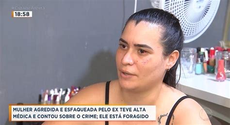 Mulher Agredida E Esfaqueada Pelo Ex Marido Em Santa Rosa De Viterbo Recebe Alta Médica