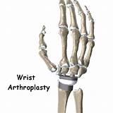 Hand And Wrist Doctor Houston Pictures