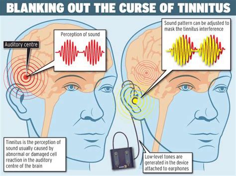 Silence Is Golden After Years Of Torturous Tinnitus Uk