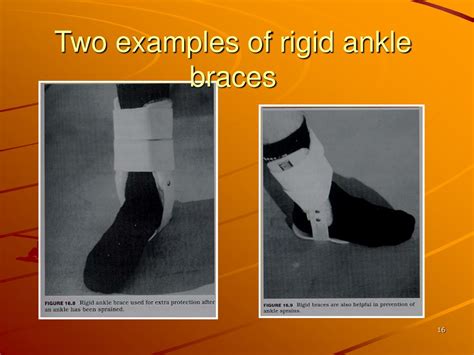 Ppt Injuries To The Lower Leg Ankle And Foot Powerpoint Presentation