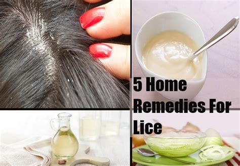 Top 5 Home Remedies For Lice Natural Treatments And Cure For Lice