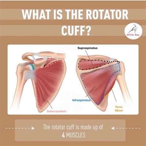 Rotator Cuff Tear Grades