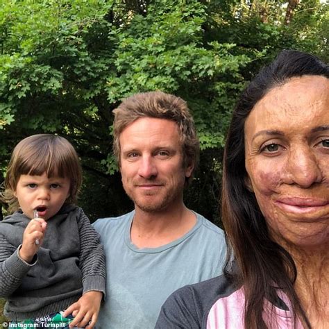 Burns Survivor Turia Pitt Shares Her Solo Parenting Struggle Daily Mail Online