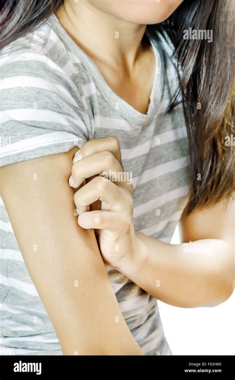 Health Problem Young Woman Scratching Her Itchy Arm With Allergy Rash