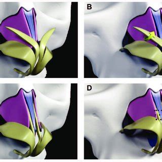 Cranio Caudal Transdomal Suture Technique Step Three Procedure Of