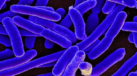 Cuáles son los síntomas de E coli