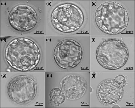 Association Between Blastocyst Morphology And Outcome Of Single