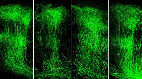 Columbia Scientists Reverse Core Symptom Of Schizophrenia In Adult Mice