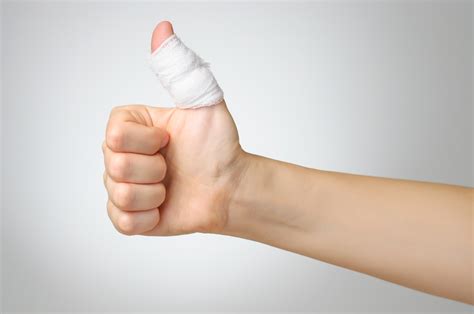 Tell If Your Thumb Is Sprained Kumwheel