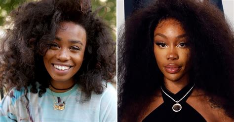 Sza Before Surgery And What She Looks Like After