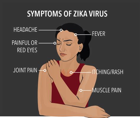 What Is Zika Virus — A Nurses Fact Sheet Nursebuff