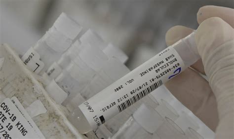 In england, the vaccine is being offered in some hospitals and pharmacies, at local. Anvisa autoriza uso emergencial e temporário de vacina ...