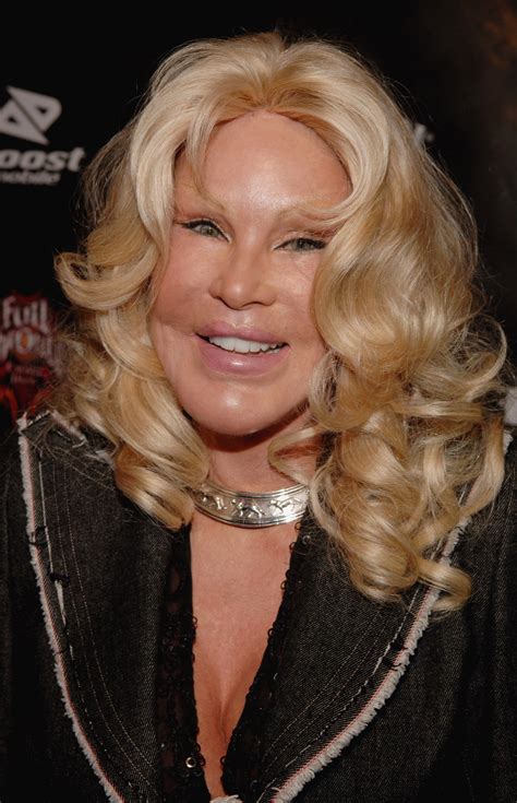 See Jocelyn Wildensteins Shocking Plastic Surgery Transformation Right