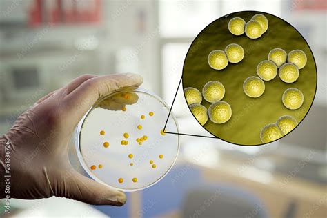Colonies Of Micrococcus Luteus Bacteria On Agar Plate And Close Up View