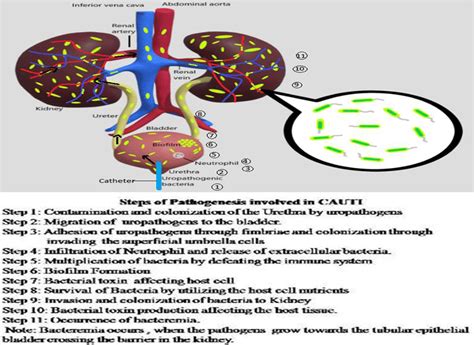 Mechanism Of Pathogenesis Of UTI Download Scientific Diagram