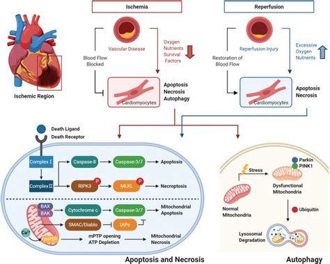 Overall Path Of Cardiomyocyte Death In Ischemic Heart Disease And
