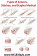 Types of Sutures, Stitches, and Staples Medical Wound Care Suturing ...