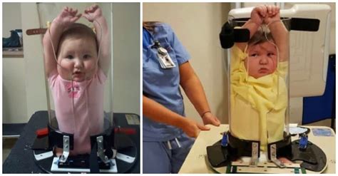 People Cant Stop Laughing At Photos Of Babies Getting X Rayed