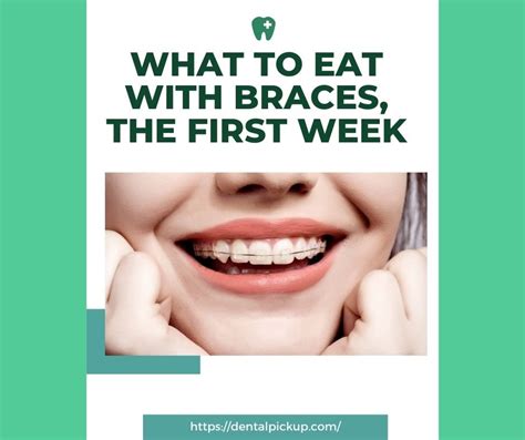What To Eat With Braces The First Week Complete Diet Plan